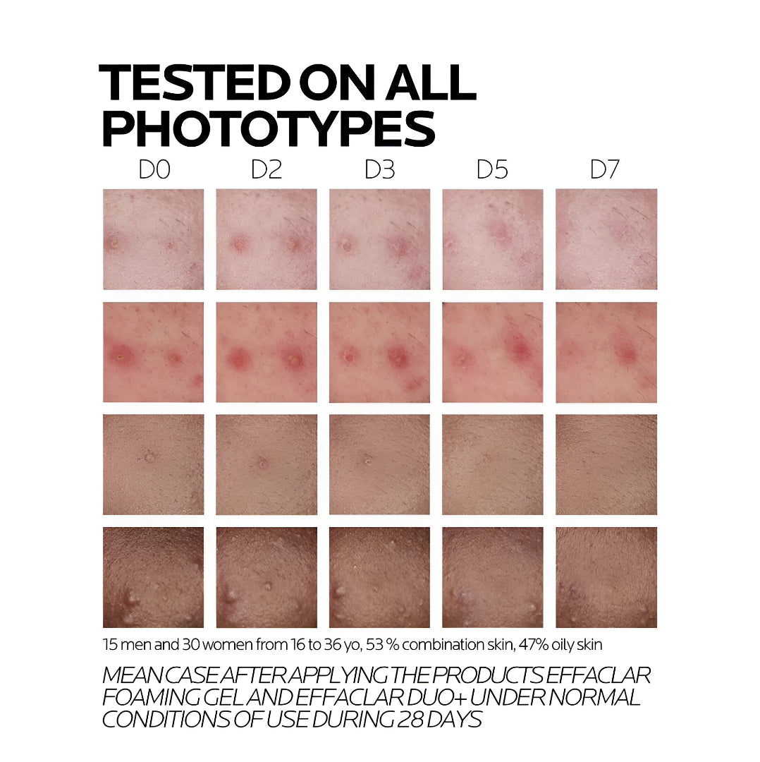 La Roche-Posay Effaclar Duo+M  40Ml